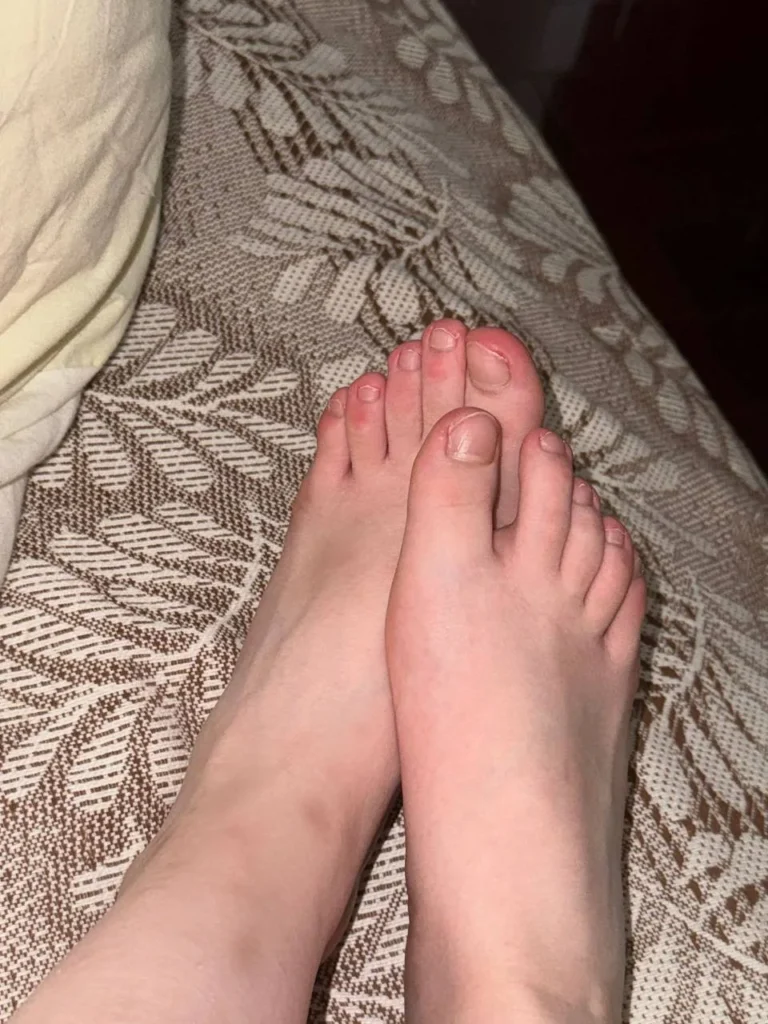 脚模面试脸足同框套路系列-219 伤痕多 [6V/9M]插图1