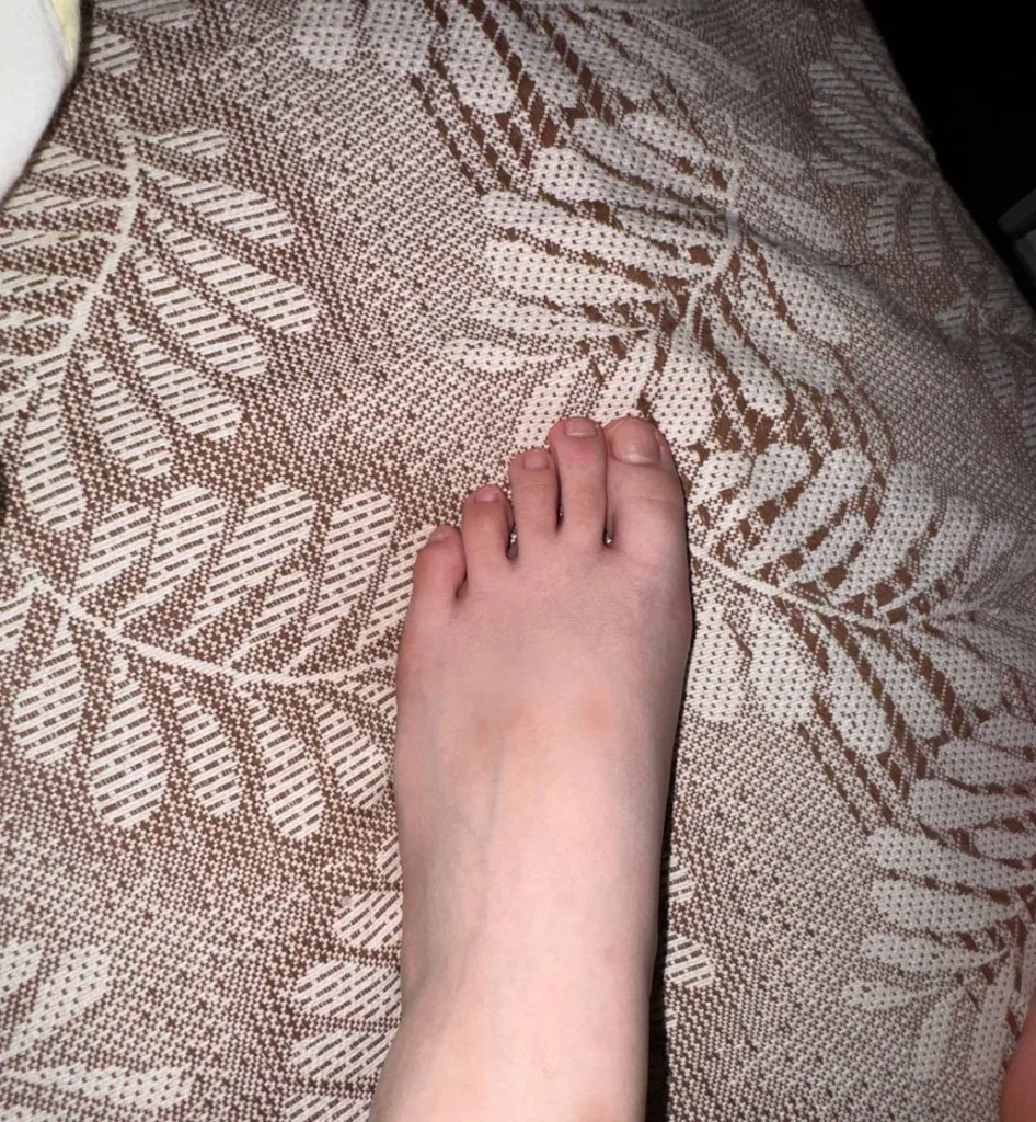 脚模面试脸足同框套路系列-219 伤痕多 [6V/9M]插图3